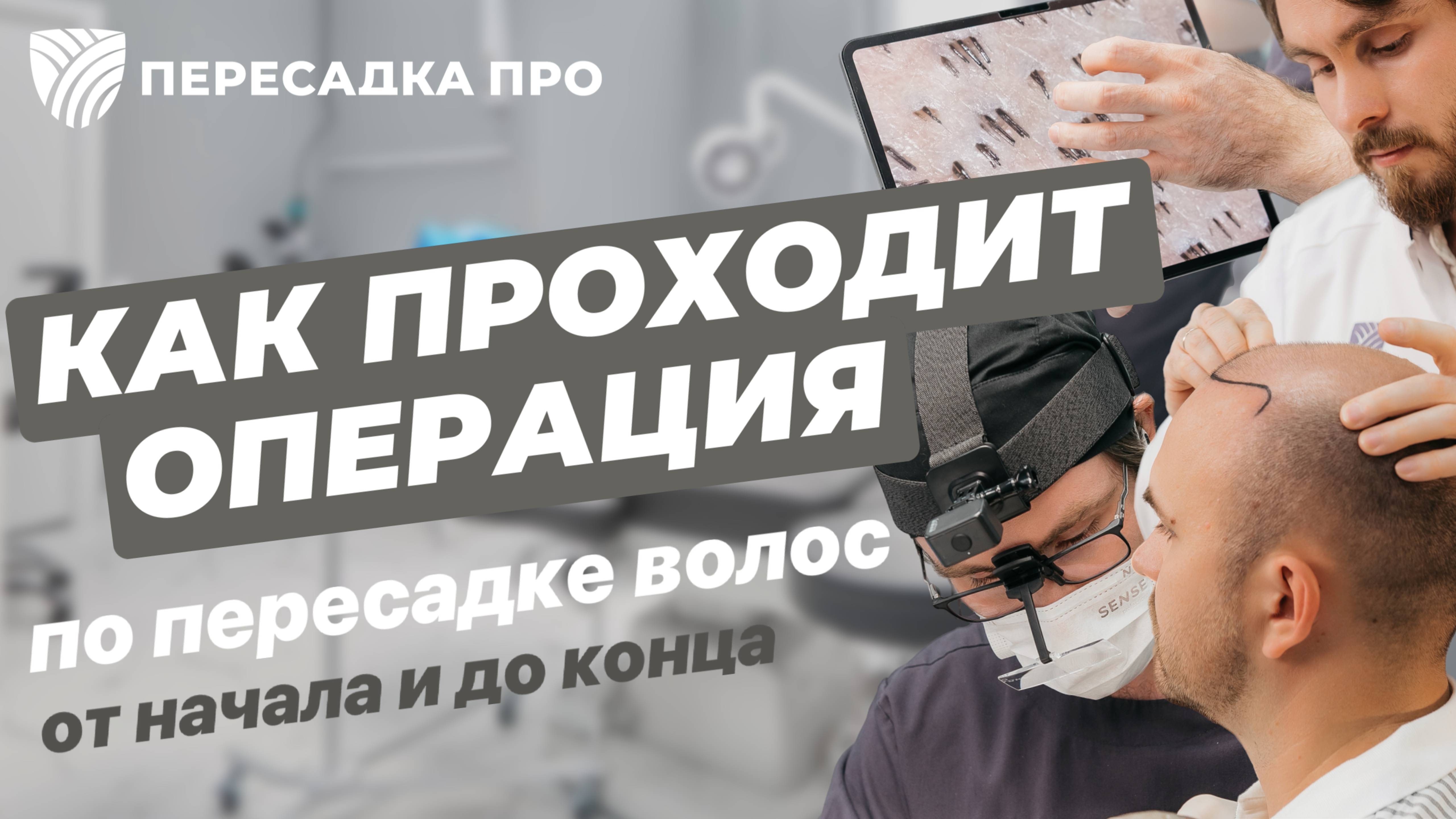 Пересадка волос от начала и до конца: как проходит операция  Пересадка ПРО