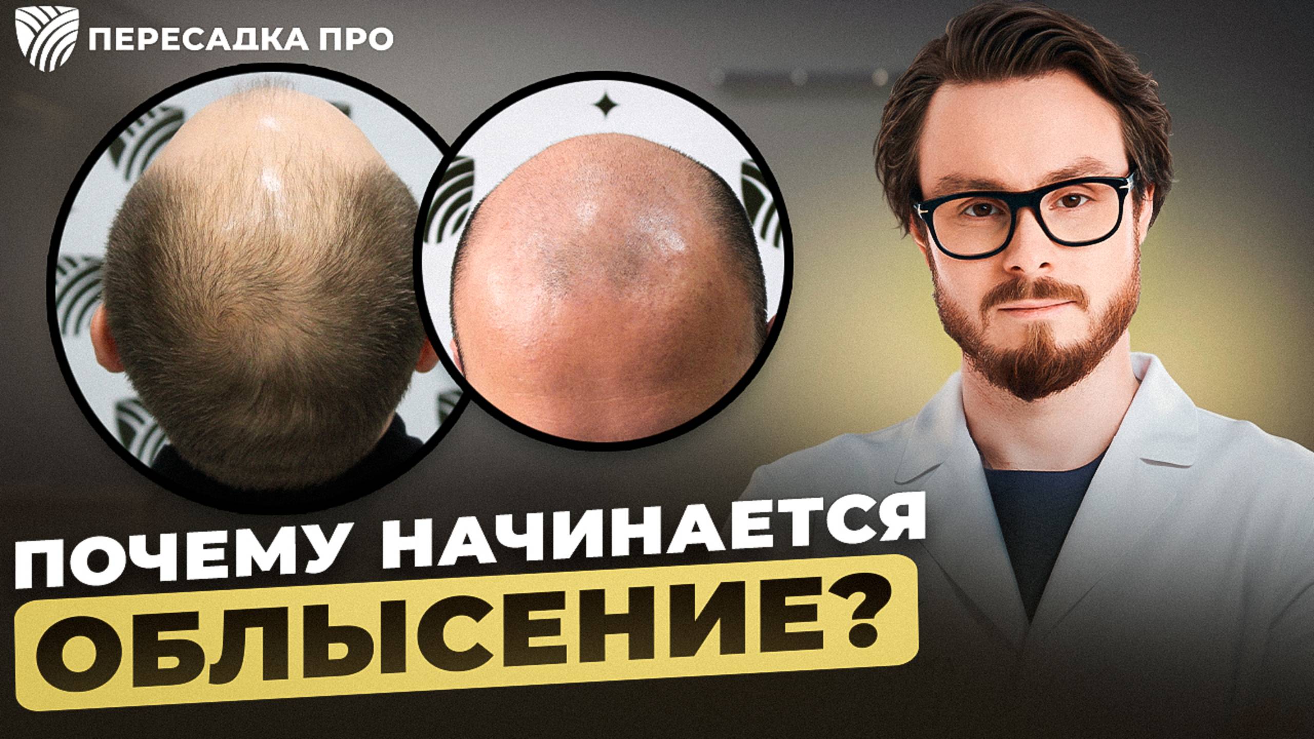 Слово хирурга  Почему выпадают волосы и когда это повод для тревоги? Илья Денисов