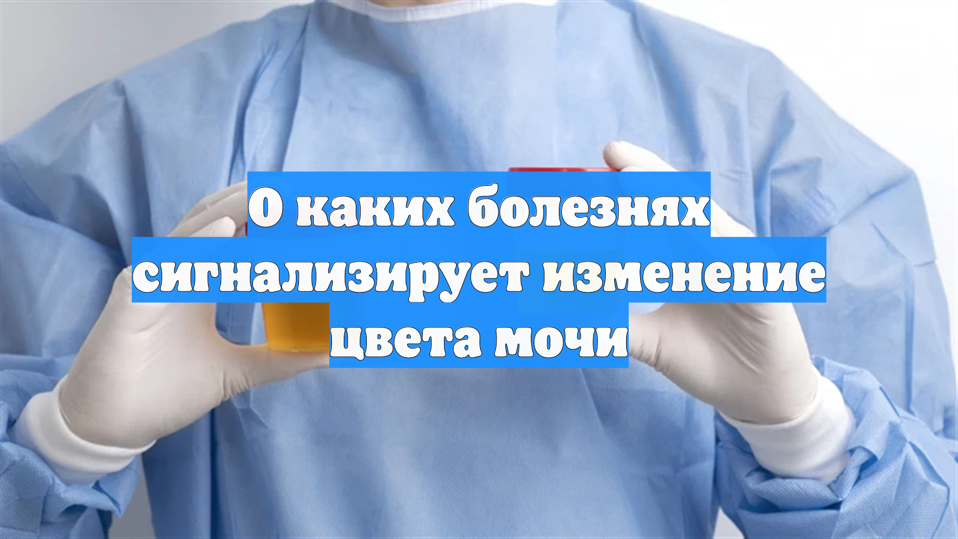 О каких болезнях сигнализирует изменение цвета мочи