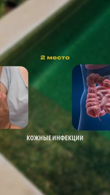 НЕДОСТАТОЧНАЯ ДЕЗИНФЕКЦИЯ  #автоматика #бассейн# #дезинфекция