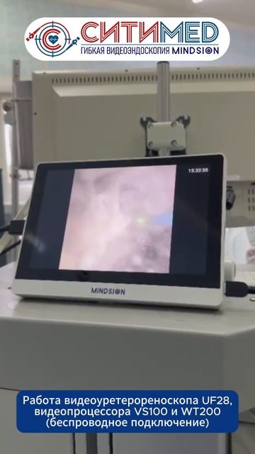 Удобно работать с большими камнями! Многоразовый беспроводной видеоуретерореноскоп Mindsion UF28