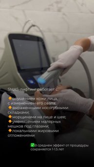 Зачем делать СМАС-лифтинг?