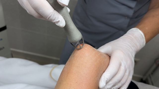 CO2 шлифовка