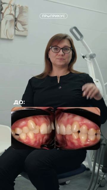До/После - исправление прикуса в стоматологии ПРОПРИКУС