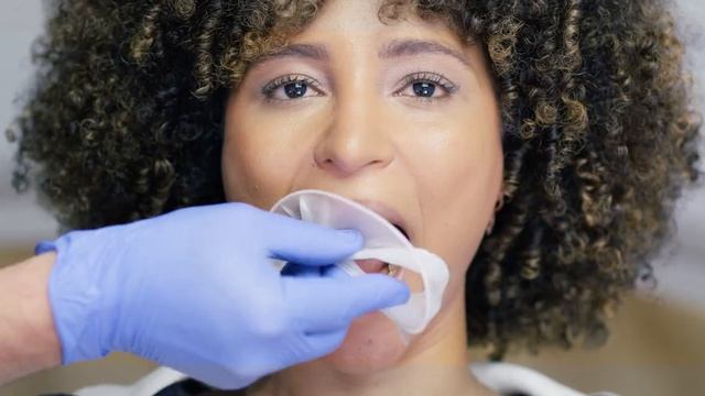 OptraGate - Easy Placement of OptraGate