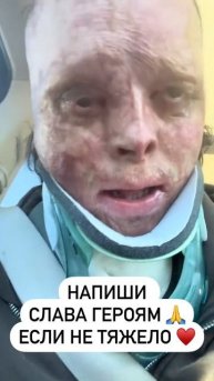 СВО👉ТЕЛЕГРАММ👈