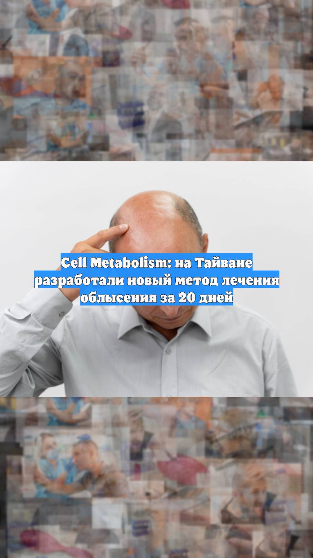 Cell Metabolism: на Тайване разработали новый метод лечения облысения за 20 дней
