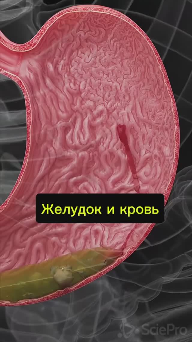 Кровит желудок - причины