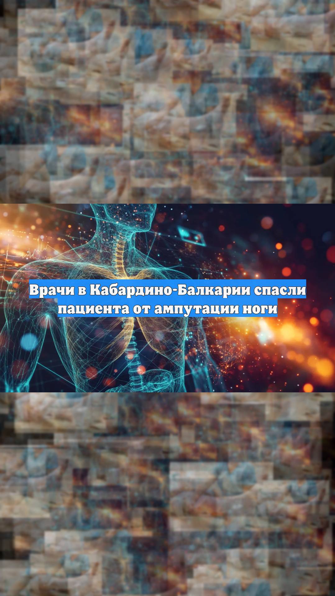 Врачи в Кабардино-Балкарии спасли пациента от ампутации ноги