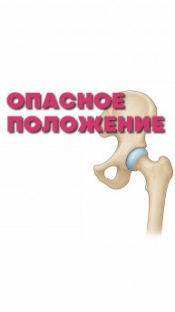 Подробнее в описании