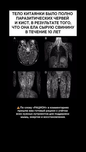 В теле китаянки все это время было это...
