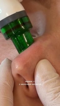 PROFACIAL — идеальный комплекс для выхода в свет ✨