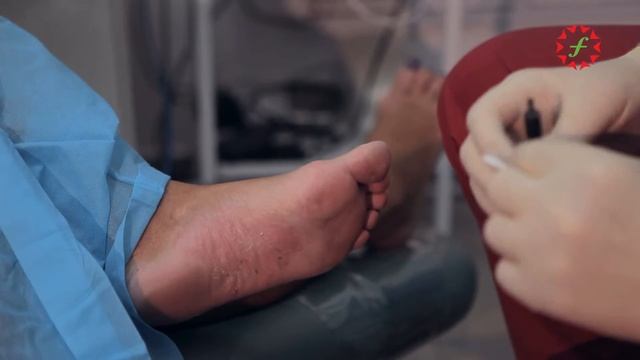 Лечение псориаза проф. Орлов А.А. Метод фотодинамической терапии с препаратом фотодитазин