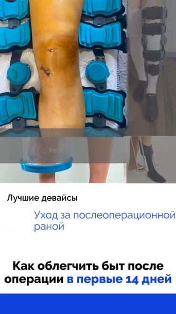 Как облегчить быт после операции на коленном суставе? Дивайсы и советы