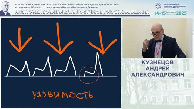 Монофазное наполнение левого желудочка у больных с синусовым сердечным ритмом