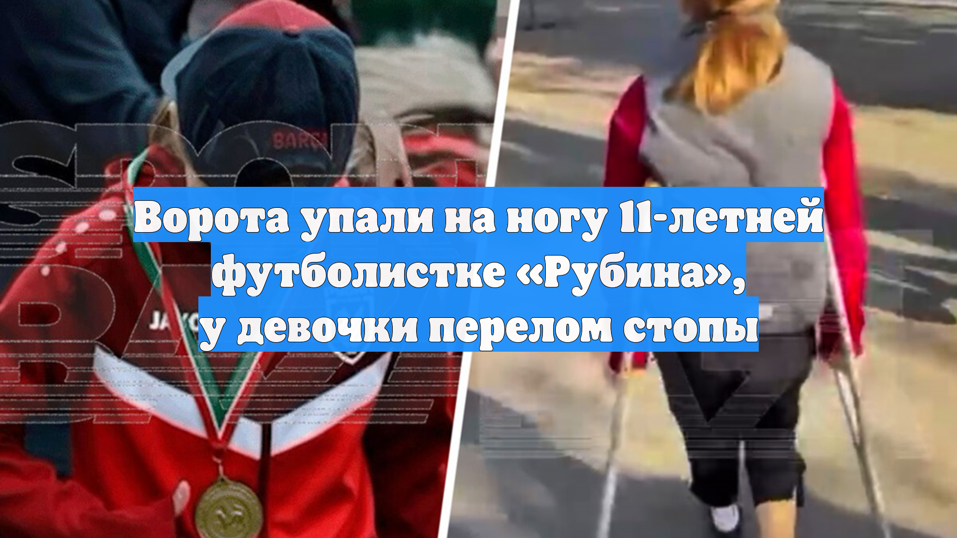Ворота упали на ногу 11-летней футболистке «Рубина», у девочки перелом стопы