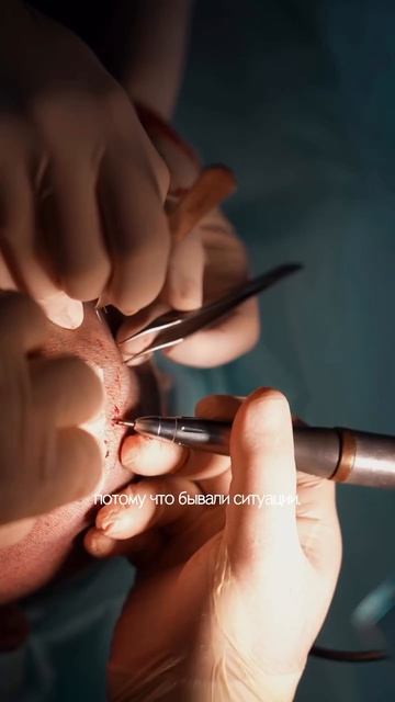 📌 Консультация перед пересадкой волос — ключевой этап