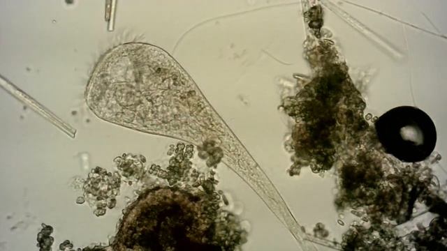 Трубач (лат. Stentor)