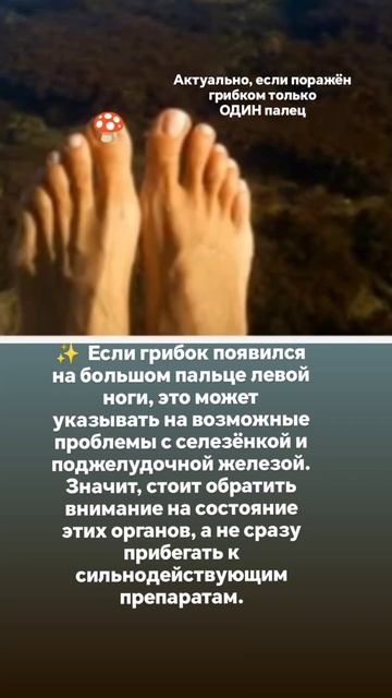 Грибок на ногтях