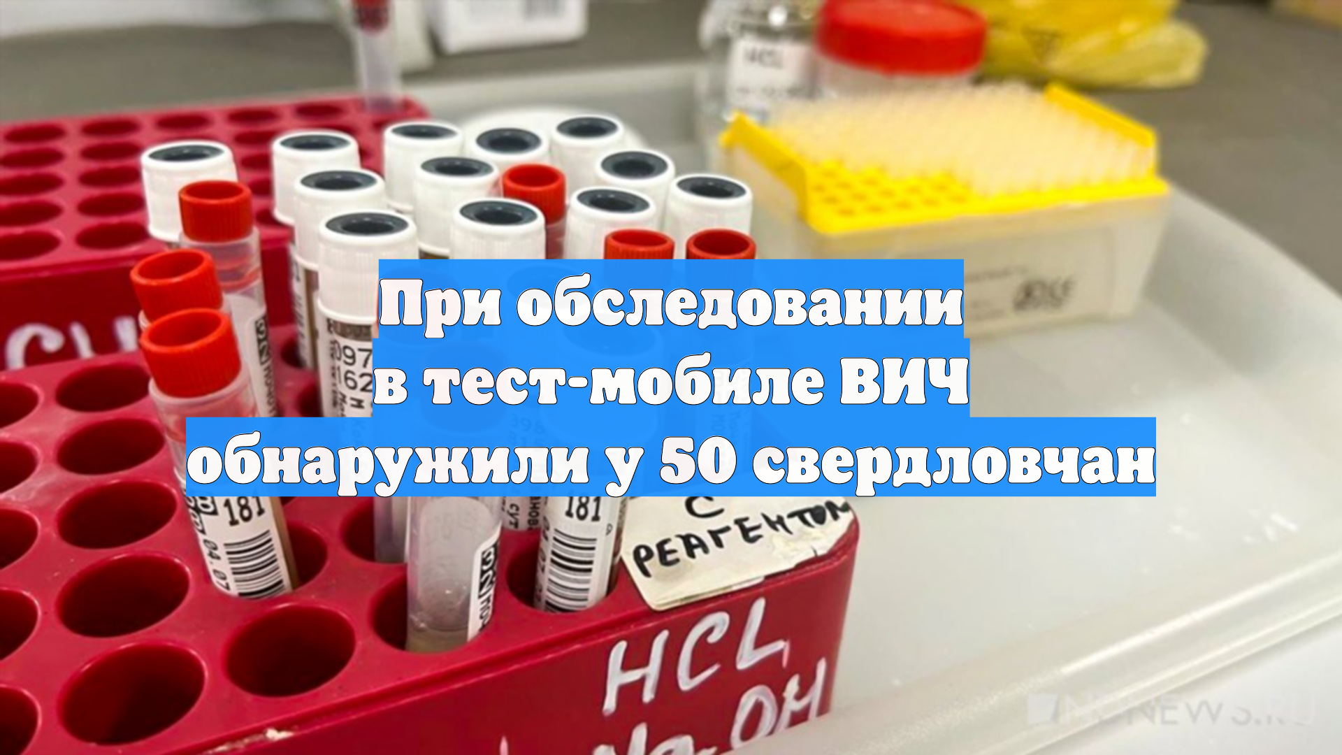 При обследовании в тест-мобиле ВИЧ обнаружили у 50 свердловчан