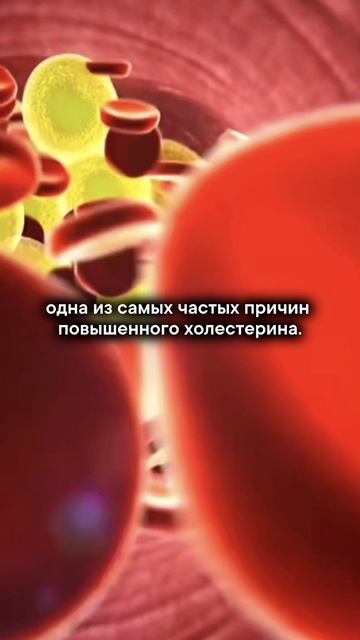 Холестерин становится опасным