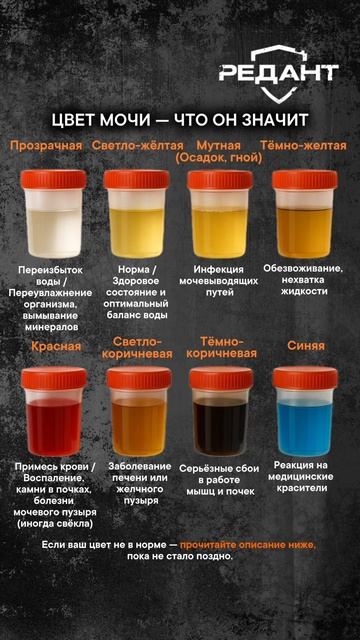 ЦВЕТ МОЧИ — ЧТО ОН ЗНАЧИТ