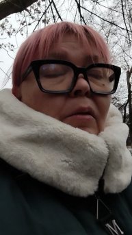 Челюсти сидят идеально, сделали кт все отлично