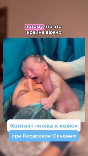 Контакт кожа к коже при кесаревом сечении #новорожденный #мама #грудное_вскармливание #роды #роддом