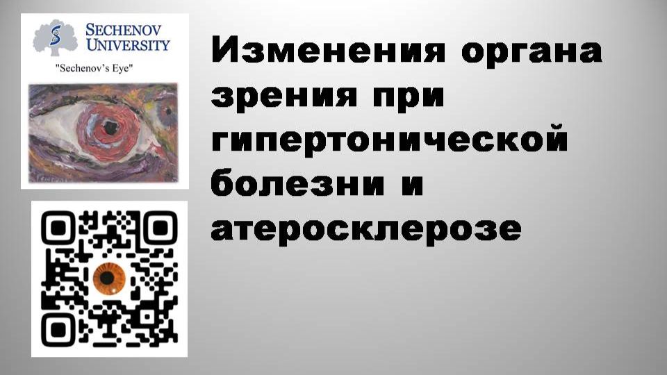Изменения органа зрения при гипертонической болезни и атеросклерозе
