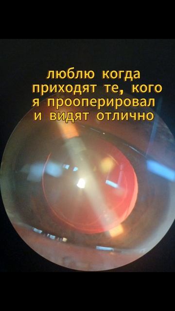 Вторичная катаракта