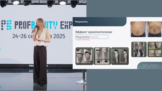 Идеальное тело без спорта: Cryolysis + UltraFormix – пошаговый протокол от Виталии Новицкой