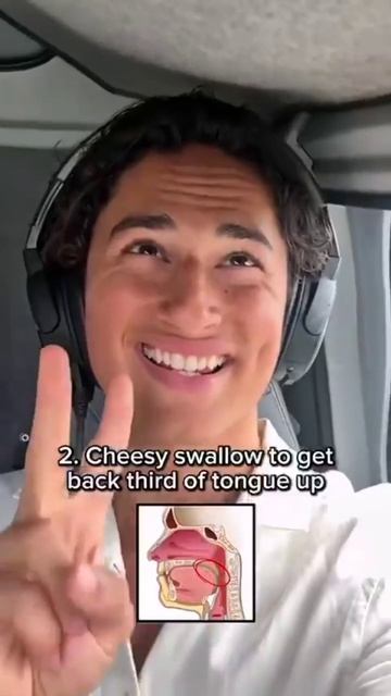 Парень исправил асимметрию лица с помощью упражнений и за 175 дней стал буквально гигачадом