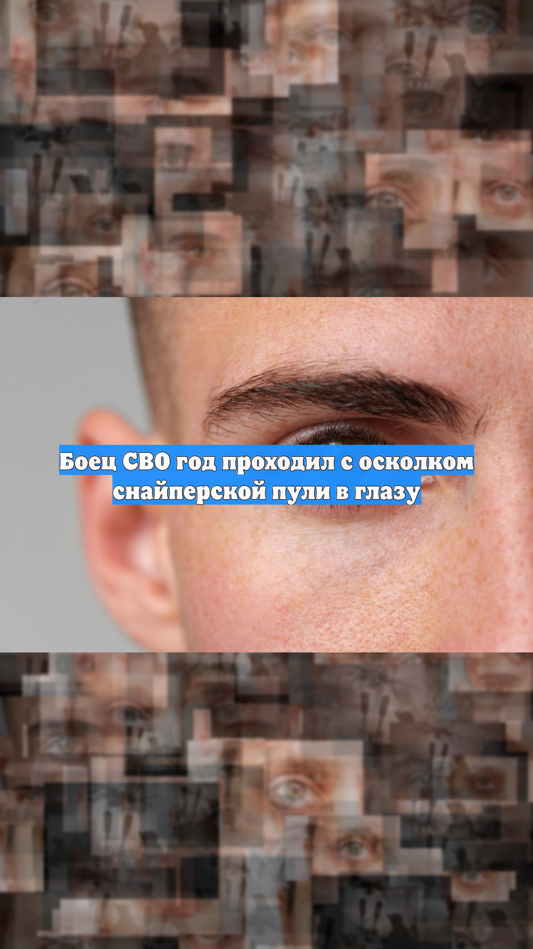 Боец СВО год проходил с осколком снайперской пули в глазу