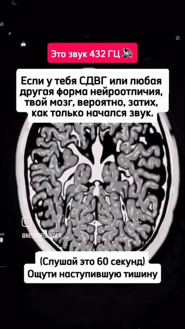 В сети нашли звук, который успокаивает людей с СДВГ и другими нейроотличиями