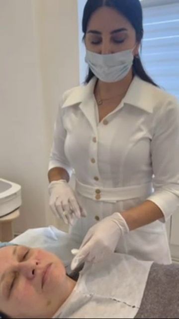 Мезоскульпт для улучшения контура лица