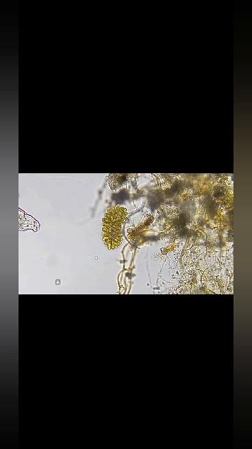 🪴🍀🦠Микро Организмы#Бактерии#Микробы#МикроОрганизмы#🦠🍀🪴