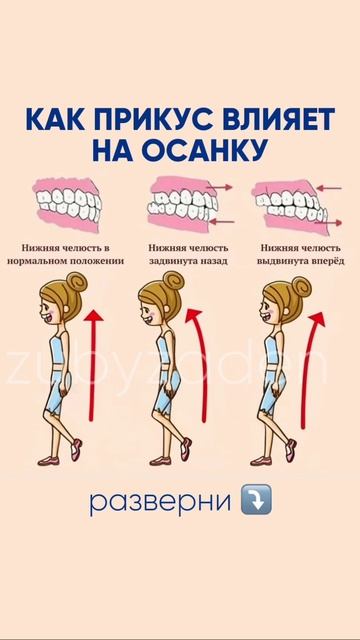 Как зубы влияют на осанку?