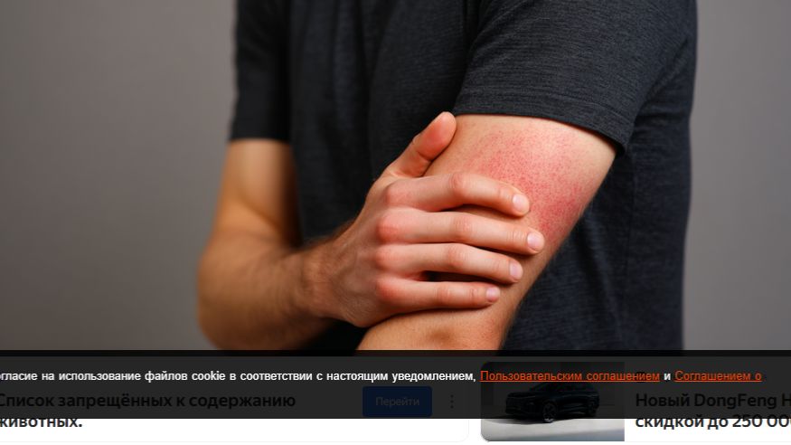 Вспышку викторианской болезни зафиксировали в Великобритании