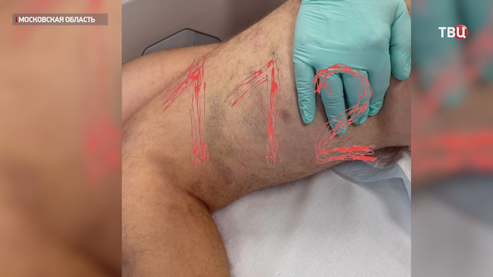 Издевательства и пытки вместо терапии: шокирующие подробности о рехабе в Подмосковье