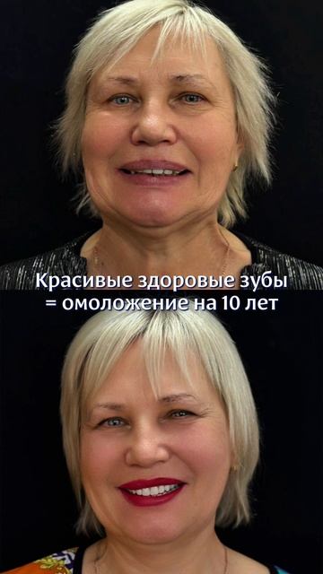 До и после пациента