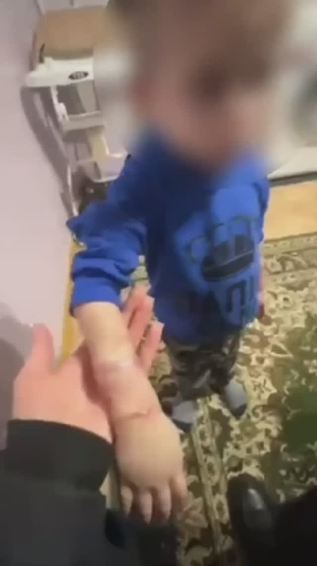 В Якутии мать жестоко избивала сына и морила его голодом