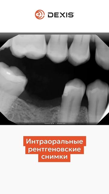 Преимущетсва DTX Studio Clinic