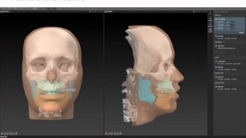 Рабочий процесс 6 - Планирование перемещения _ IPS CaseDesigner® Руководство