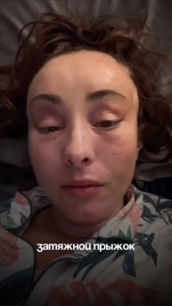 Пытаюсь не ныть #пластикалица