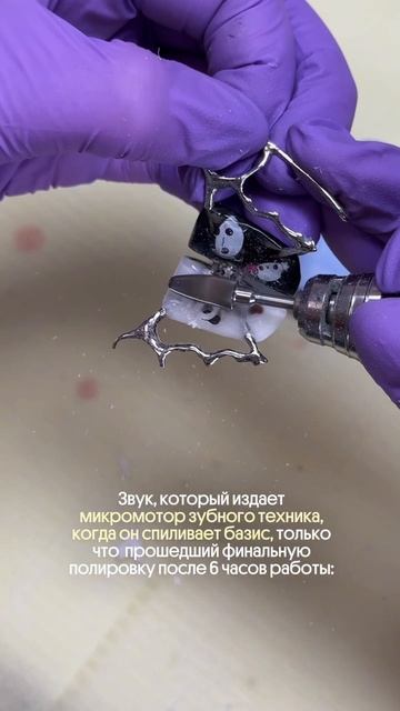 Мы не скажем, что в DENTIKA работают перфекционисты, но знаки будут 😂