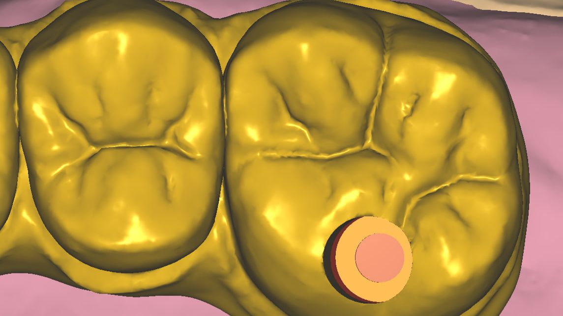 Формирование фиссур #2