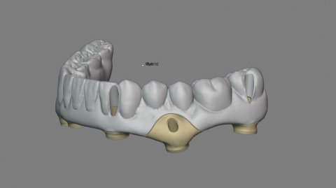 Балочная конструкция с разделением одного из сегментов
