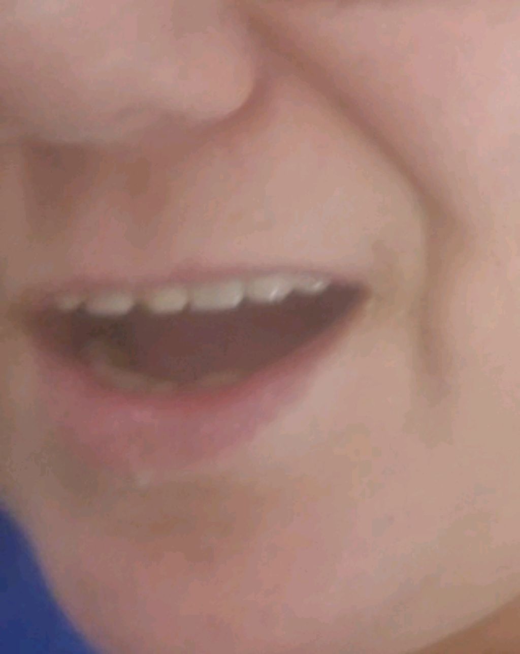 поломался протез 5.12.25