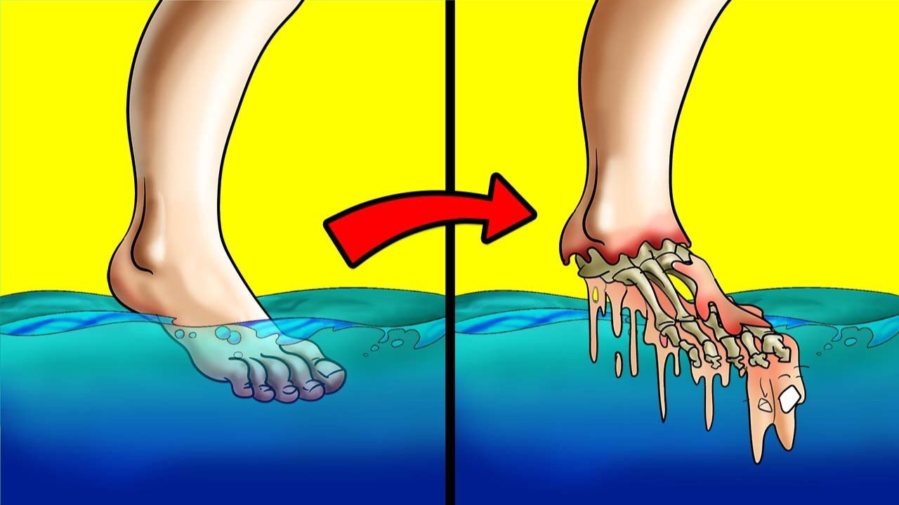 Если Окунуть Палец В Это Озеро, Вы Умрёте