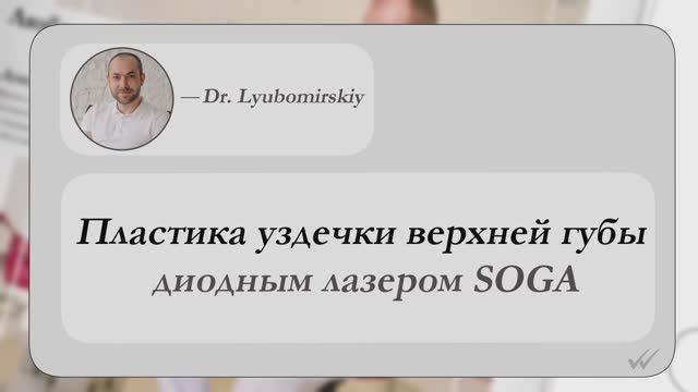 Пластика уздечки верхней губы диодным лазером SOGA